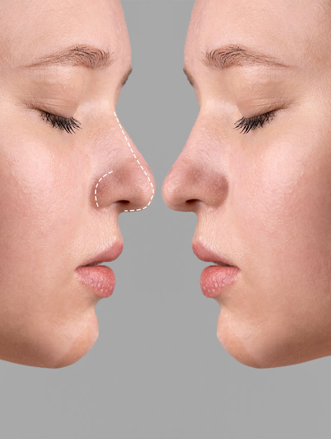 Image hover effect image